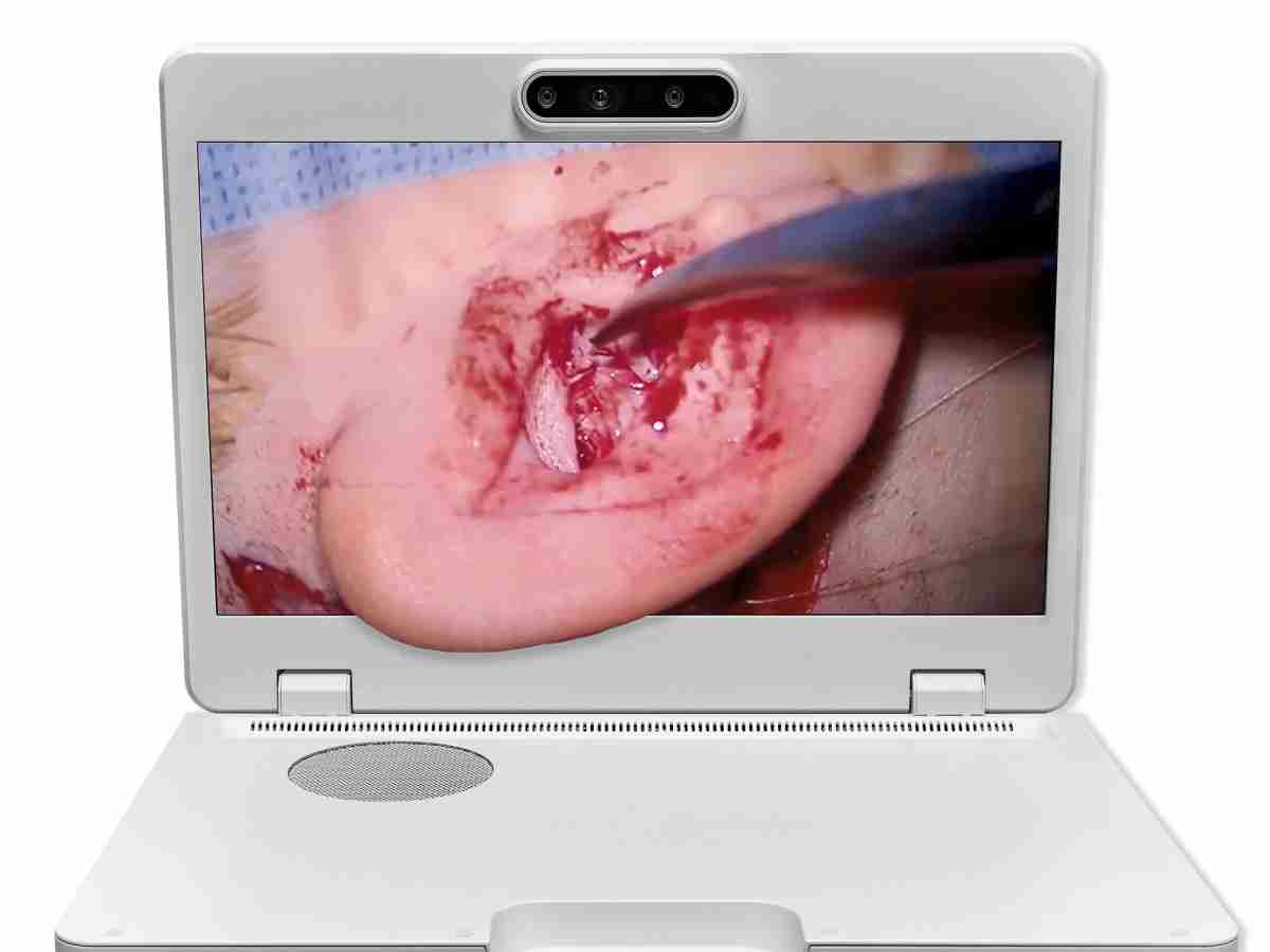 达擎之＂Heads-up 3D显微手术显示系统＂，，，整合4K裸眼3D显示及眼球追踪系统，，，，具备快速追踪人眼移动位置功能，，，减轻医师长时间维持固定姿势的负担，，，，让医师能有更宽广清晰的3D立体视野及更舒适的姿势来执行手术。。